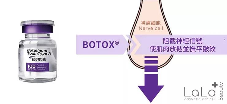 【瘦面祛皺】Botox A型肉毒桿菌素針劑 全球第一獲美國FDA認可